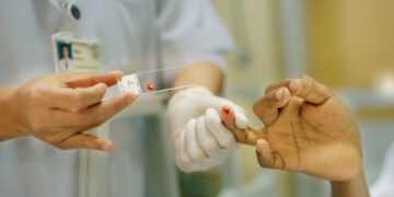 Emiten una alerta sanitaria al conﬁrmarse dos casos de malaria en Florida